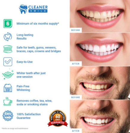 Cleaner Smile Teeth Whitening Kit Instructions