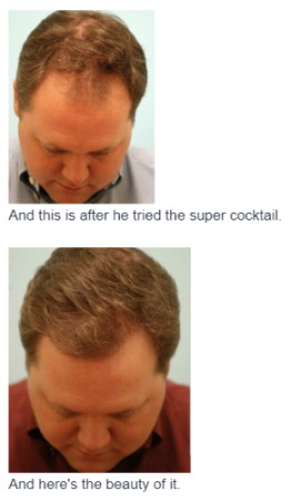 Follicle Revival Hair Loss Reviews