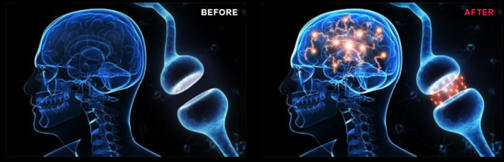 Myco Nootropic Brain Gummies before & after