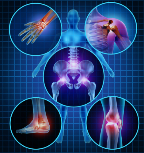 Joint Pain Protocol Program