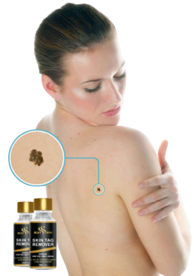 Silky Skin Tag Remover - A women shows how to use it.