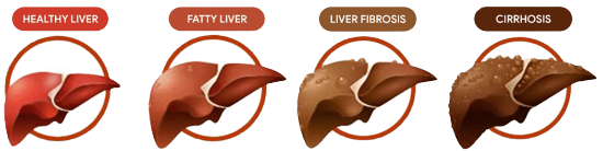 Triple Liver Health Supplement - Healthy liver support formula