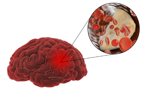 Neurotol Ingredients