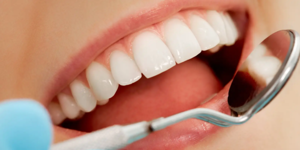Dental Sugar Hack Image