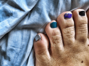 Gentian Violet for Toenail Fungus images