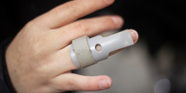 Gyroscopic Hand Therapy Device for Arthritis Image